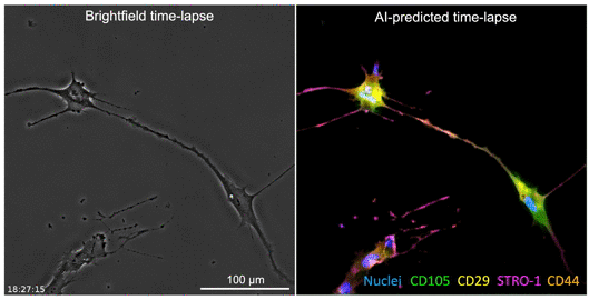 The developed AI algorithm can transform a brightfield image (left) into a fluorescent-like image (right) without sacrificing the cells to obtain. (Credit: Sara Imboden and Neil Lin.)